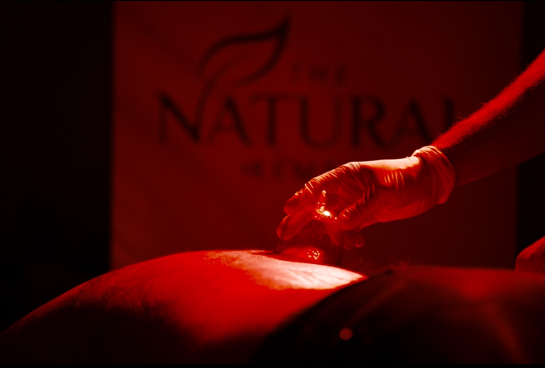 Fire cupping